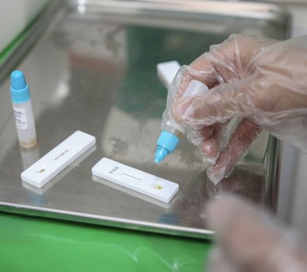 با ادامه طرح غربالگری سرطان برست و کولورکتال از ابتدای طرح تا اکنون اعلام شد؛ ۳۹۸ هزار فرصت زندگی و جهش غربالگری با موتور فولاد مبارکه